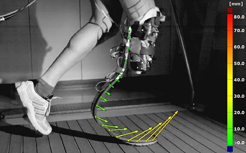 康复医疗三维扫描