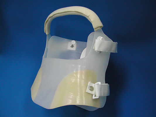 医疗核心部件逆向设计